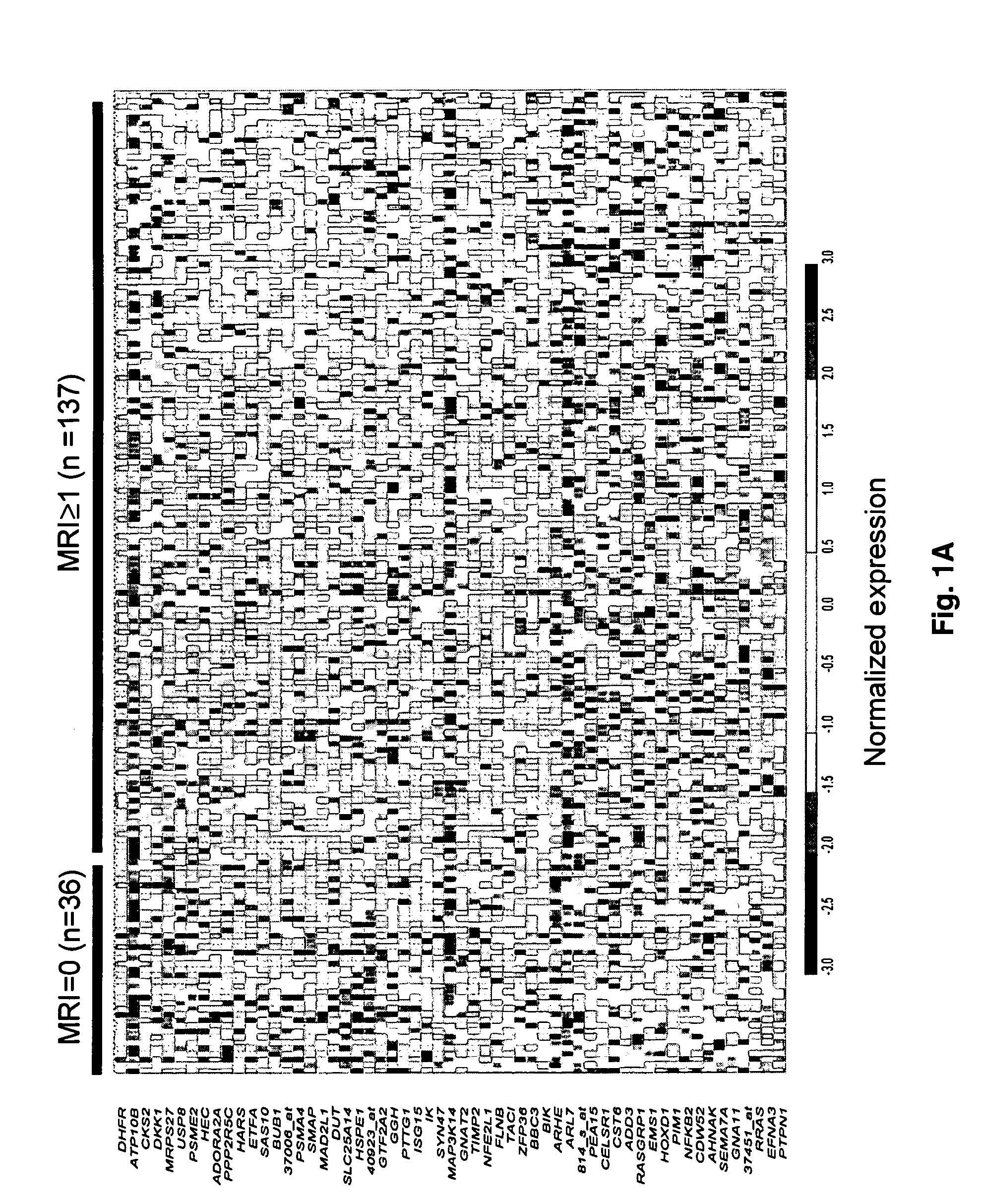 Molecular determinants of myeloma bone disease and uses thereof