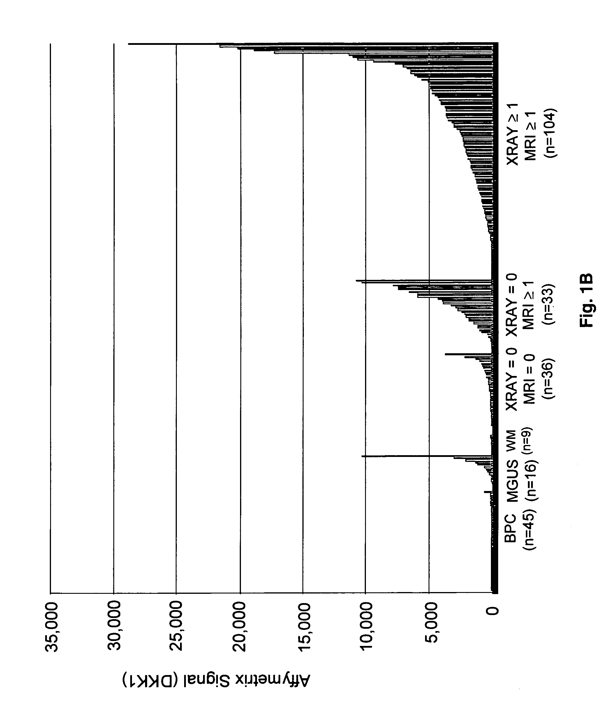 Molecular determinants of myeloma bone disease and uses thereof