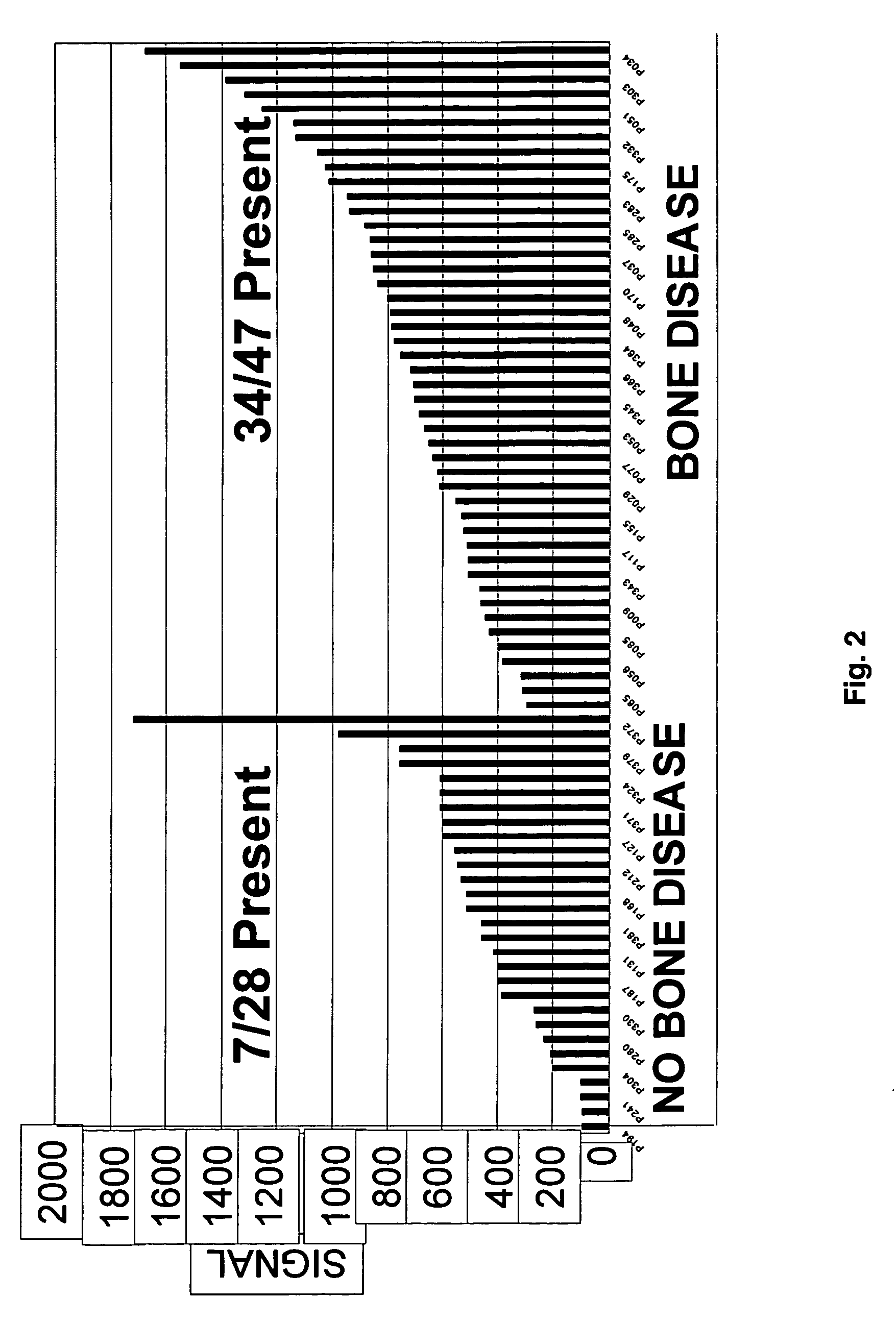 Molecular determinants of myeloma bone disease and uses thereof