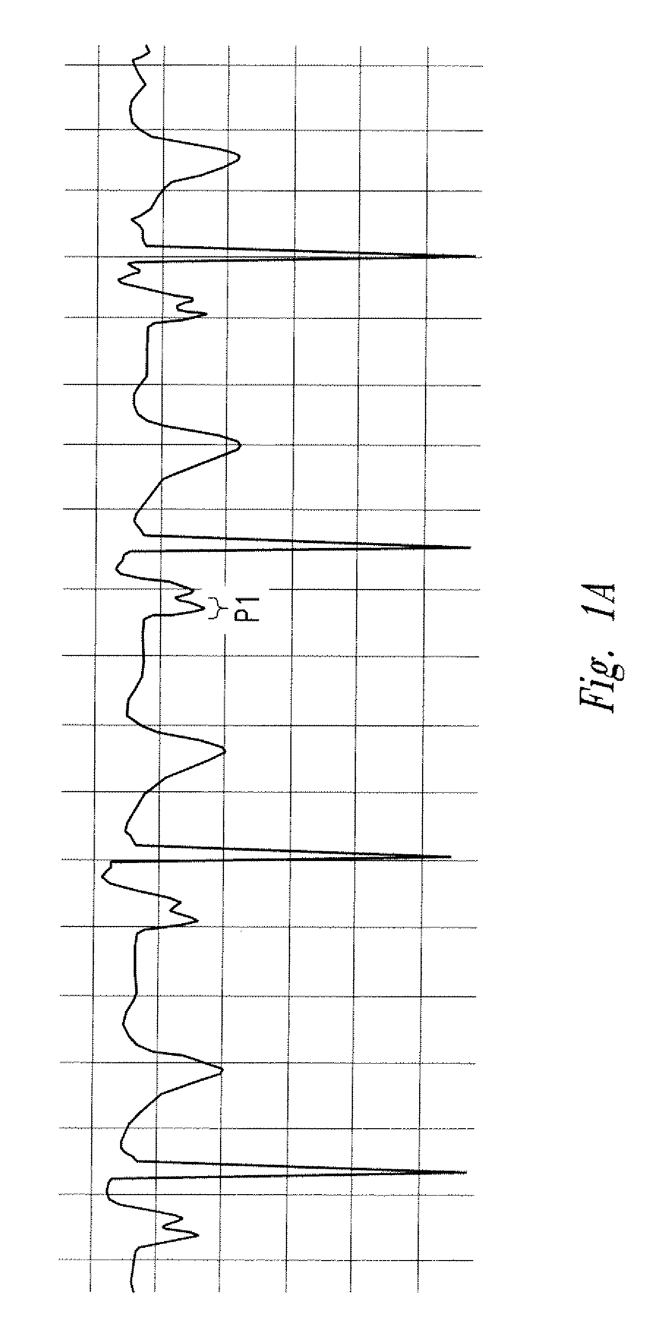 Method of locating the tip of a central venous catheter