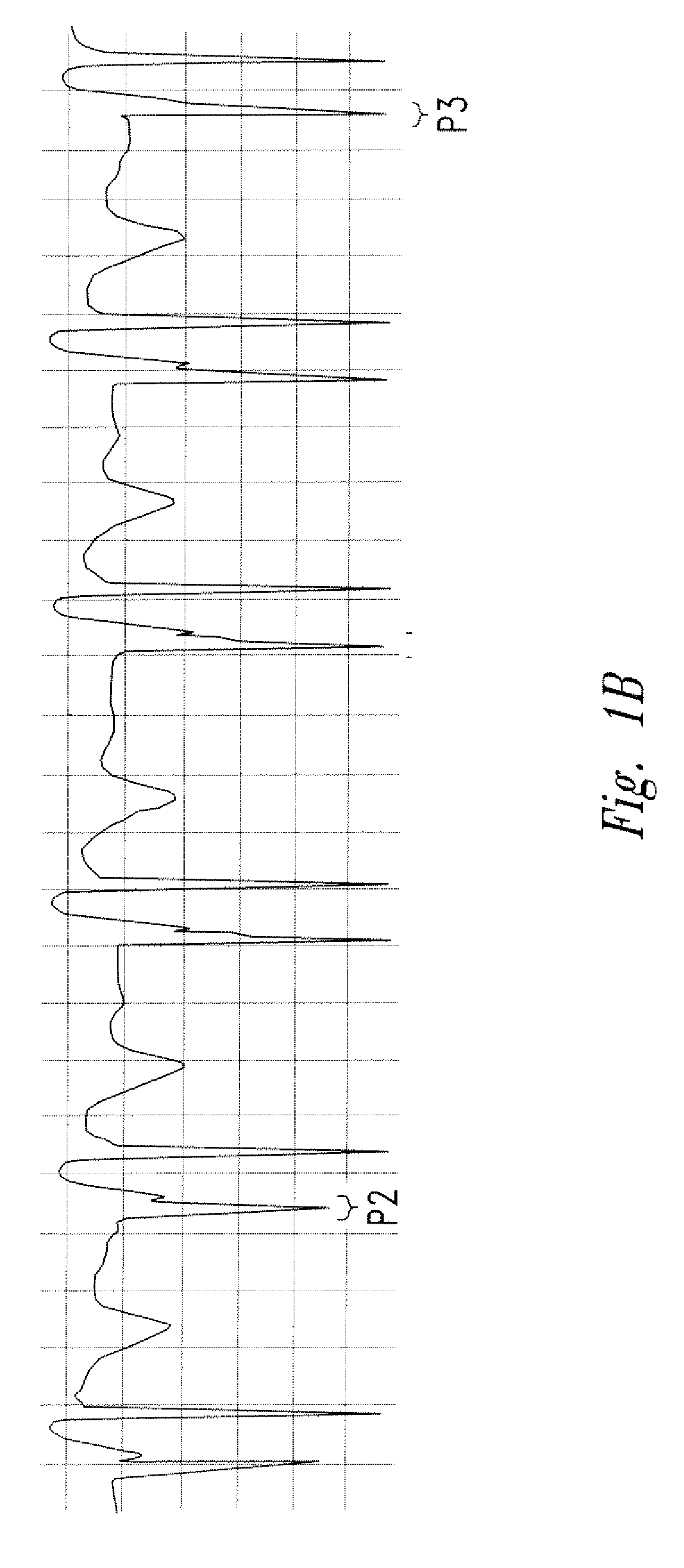 Method of locating the tip of a central venous catheter