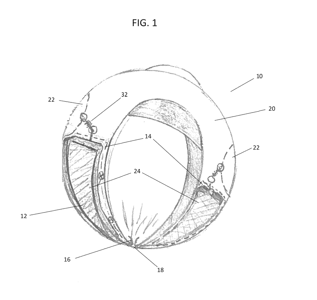 Wearable treatment substance dispenser