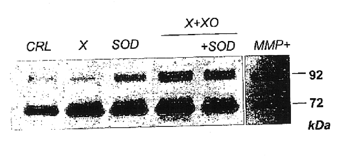 Free radical scavengers or promoters thereof as therapeutic adjuvants in preterm parturition