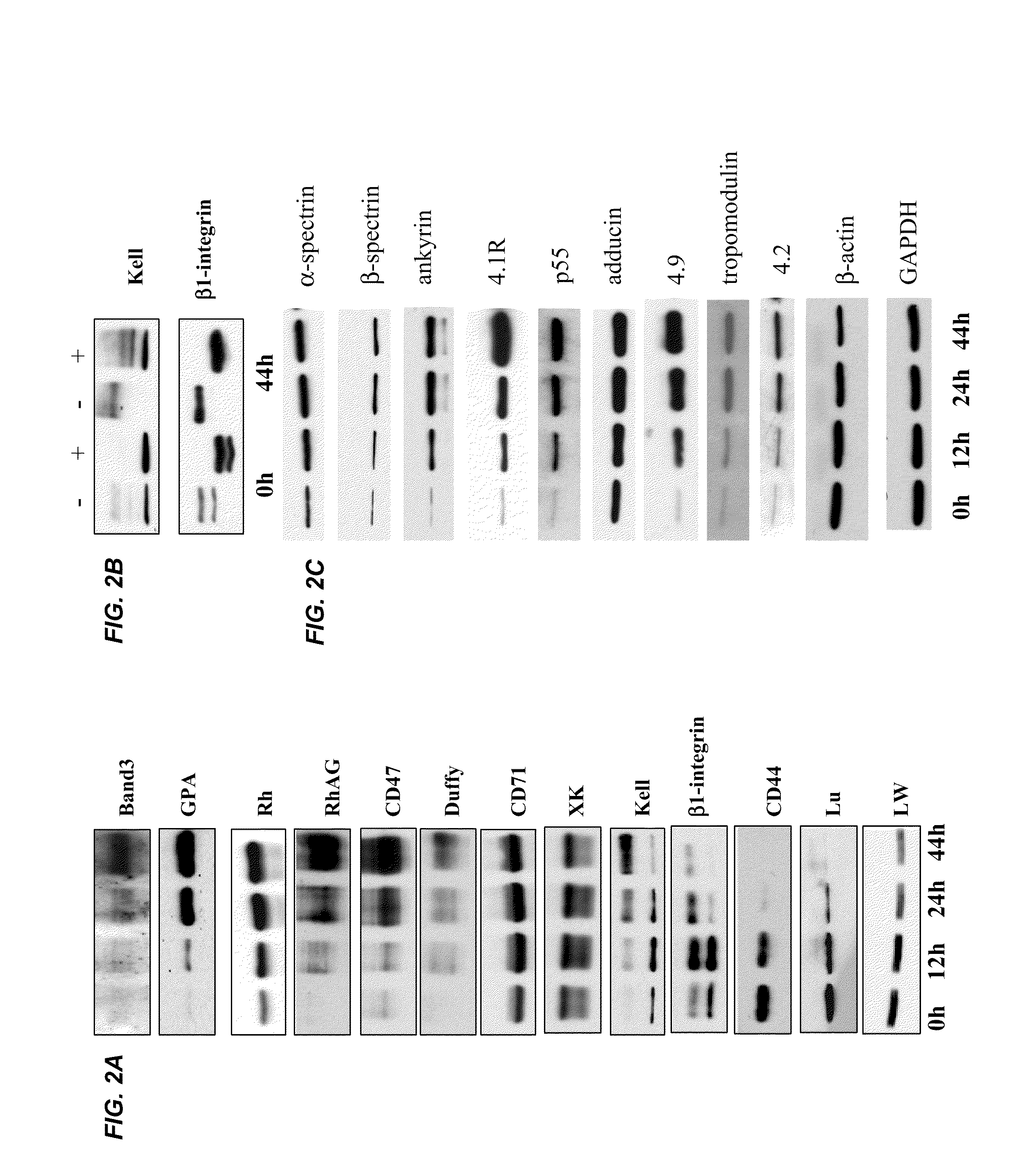 Ordered Assembly of Membrane Proteins During Differentiation of Erythroblasts