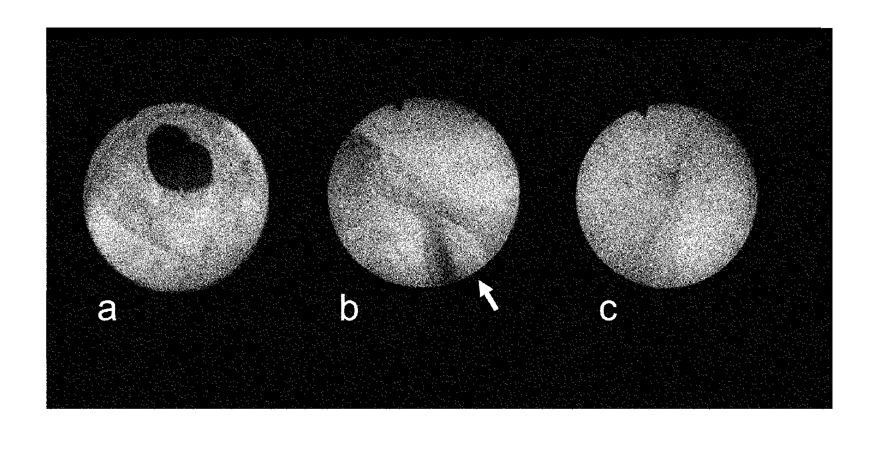 Cell preparation for erectile dysfunction or sensory disorders of the lower urinary tract containing adipose tissue derived mesenchymal stem cells