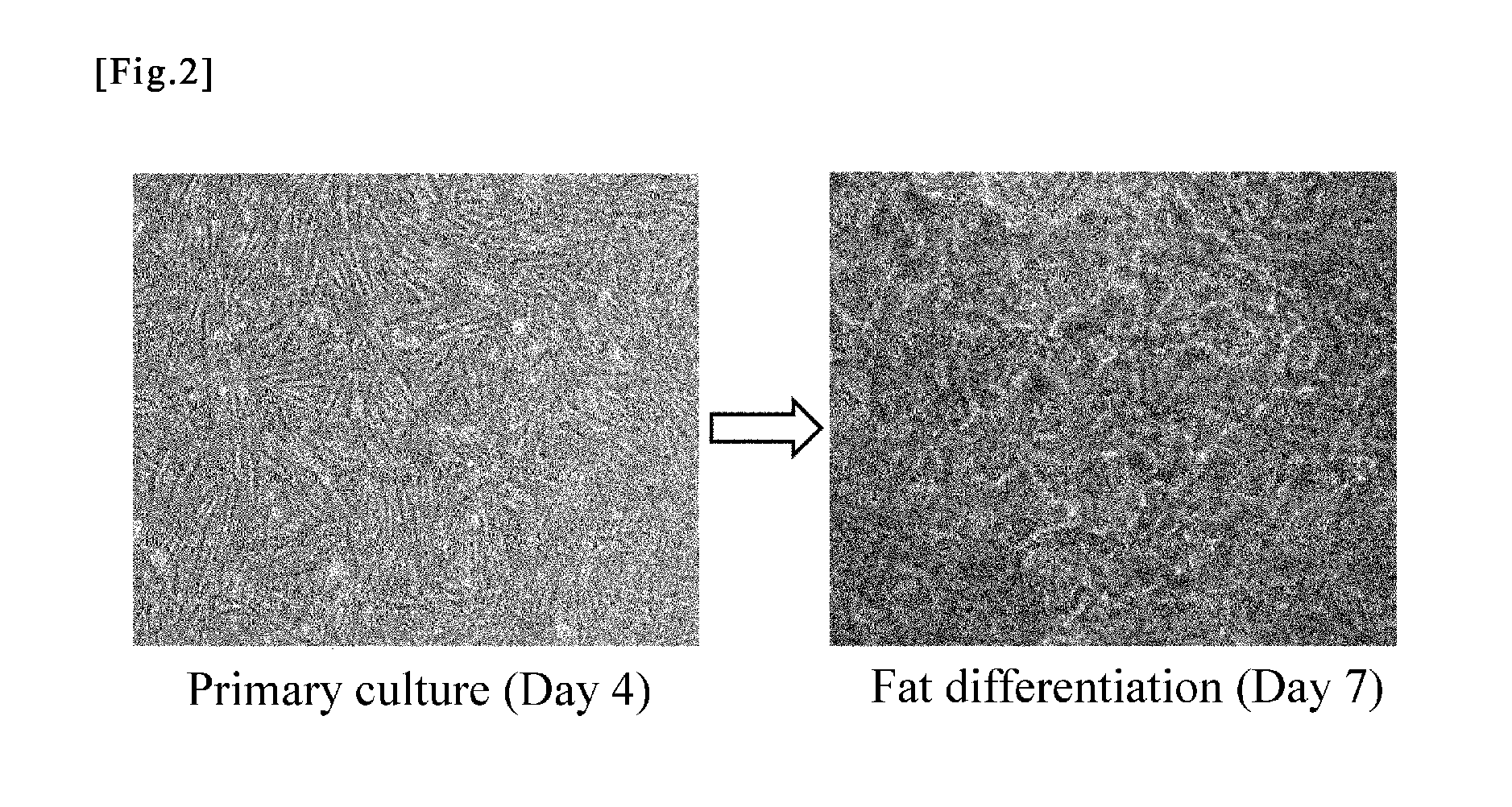 Cell preparation for erectile dysfunction or sensory disorders of the lower urinary tract containing adipose tissue derived mesenchymal stem cells