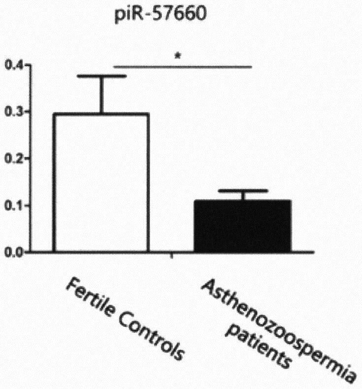 Kit for diagnosing asthenospermia through piR-57660 and application