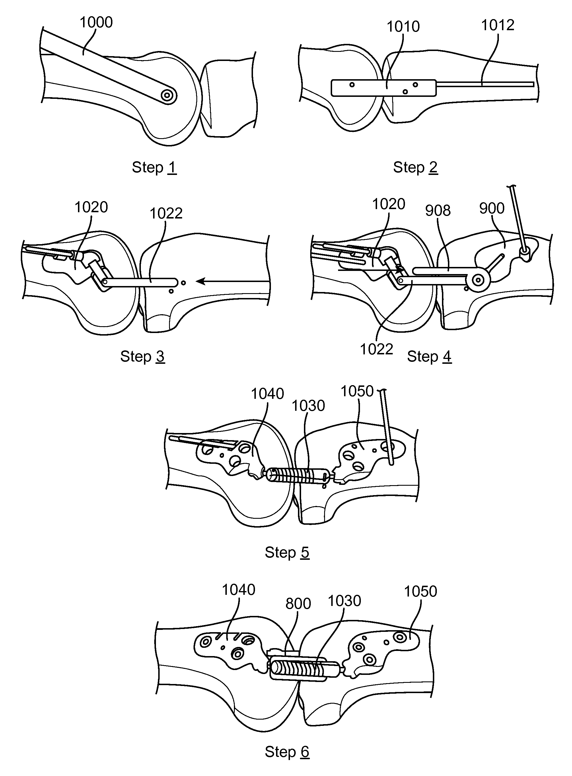 Joint Energy Absorbing System and Method of Use