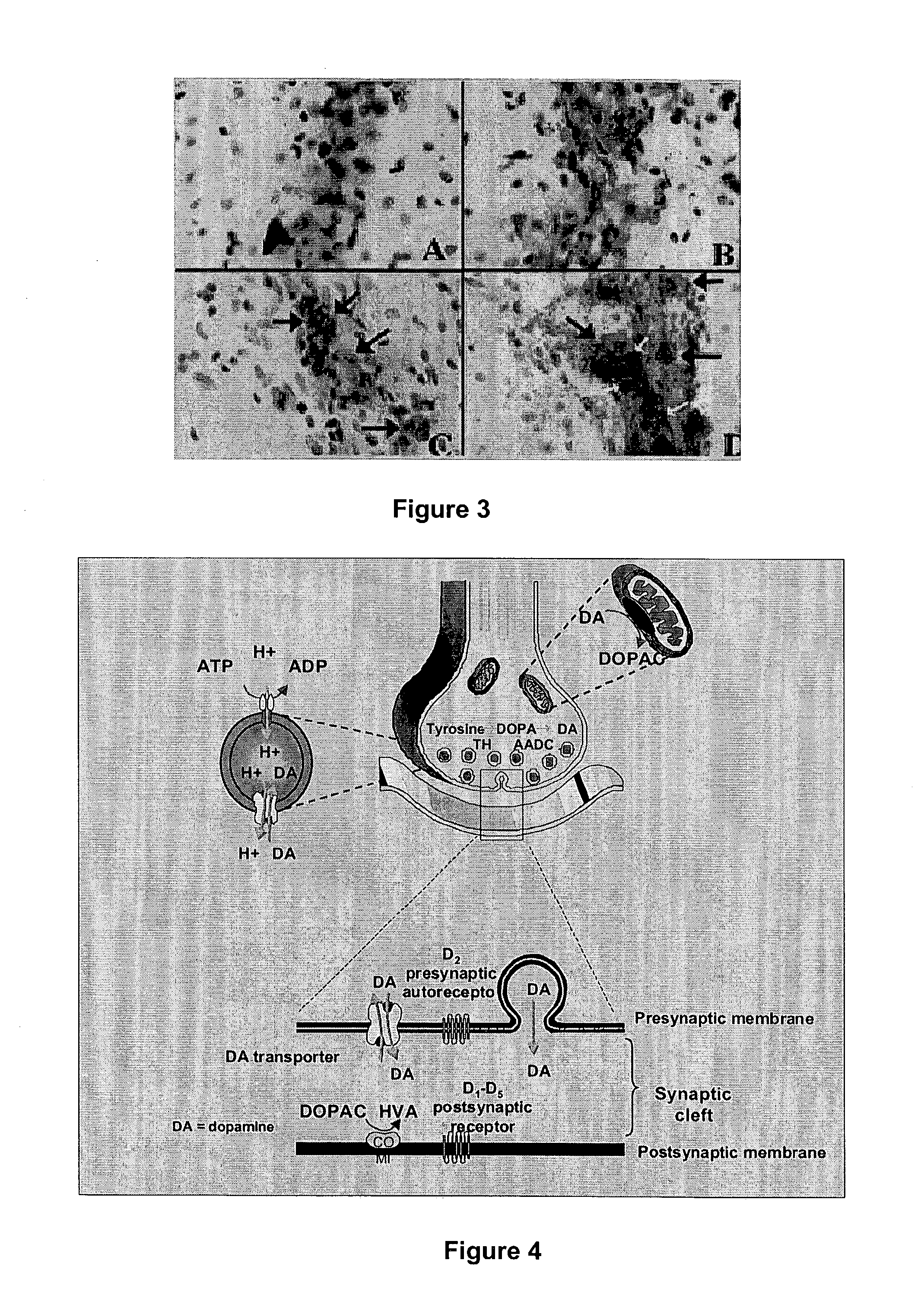 Modified retinal pigment epithelial cells for cell transplantation