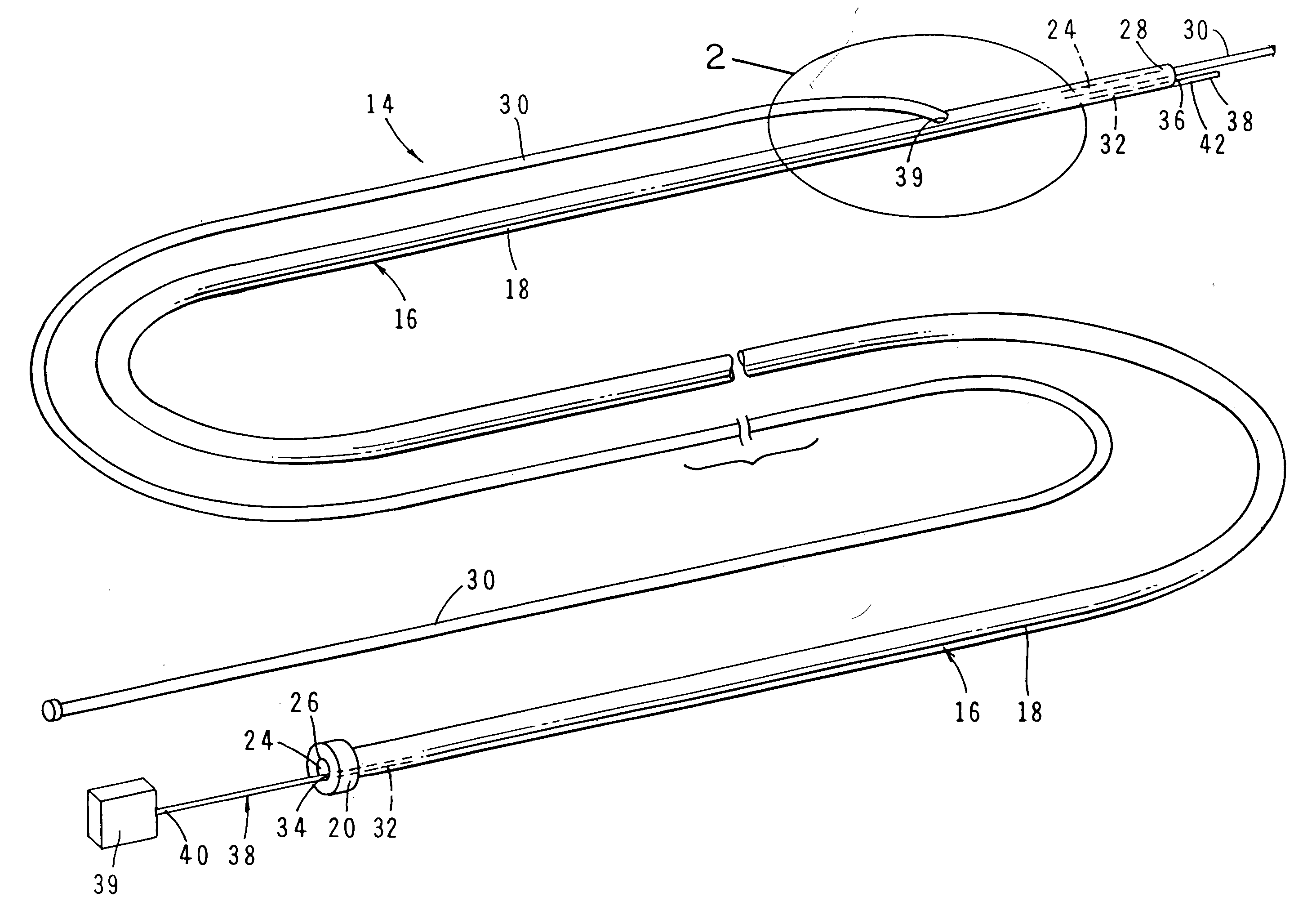 Intravascular catheter