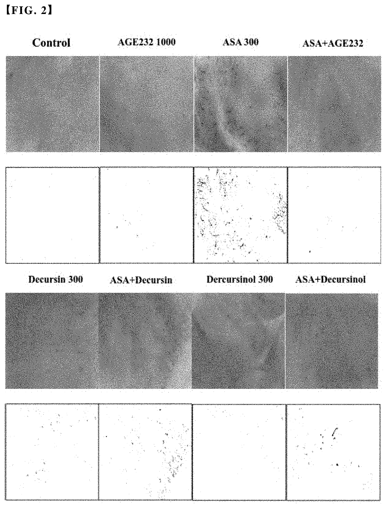 Antithrombotic composition comprising angelica gigas nakai extract