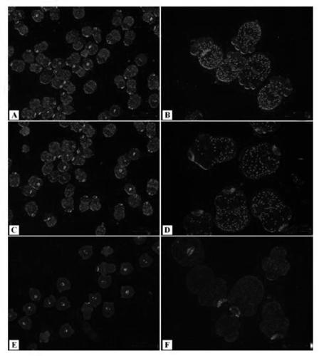 Interfering RNA (Ribonucleic Acid) for inhibiting expression of echinococcus granulosus protoscolex DNA (Deoxyribonucleic Acid) oxidative damage repairing gene and application of interfering RNA