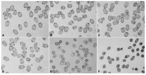 Interfering RNA (Ribonucleic Acid) for inhibiting expression of echinococcus granulosus protoscolex DNA (Deoxyribonucleic Acid) oxidative damage repairing gene and application of interfering RNA