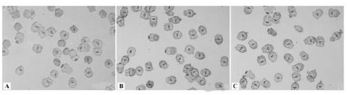 Interfering RNA (Ribonucleic Acid) for inhibiting expression of echinococcus granulosus protoscolex DNA (Deoxyribonucleic Acid) oxidative damage repairing gene and application of interfering RNA