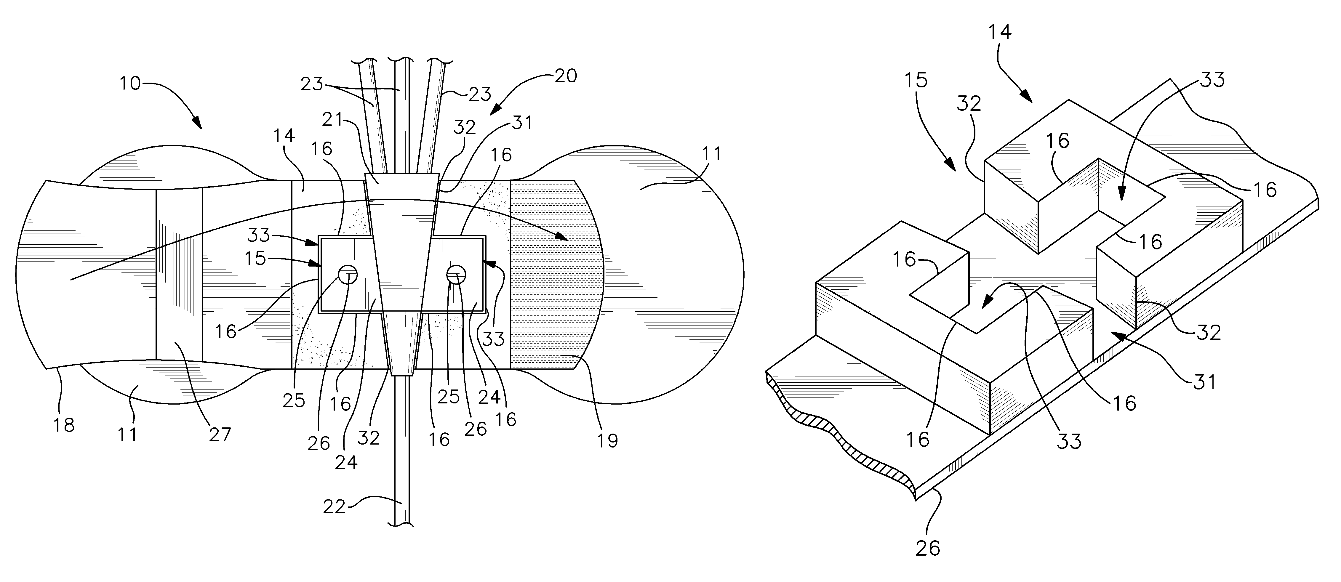 Catheter anchor