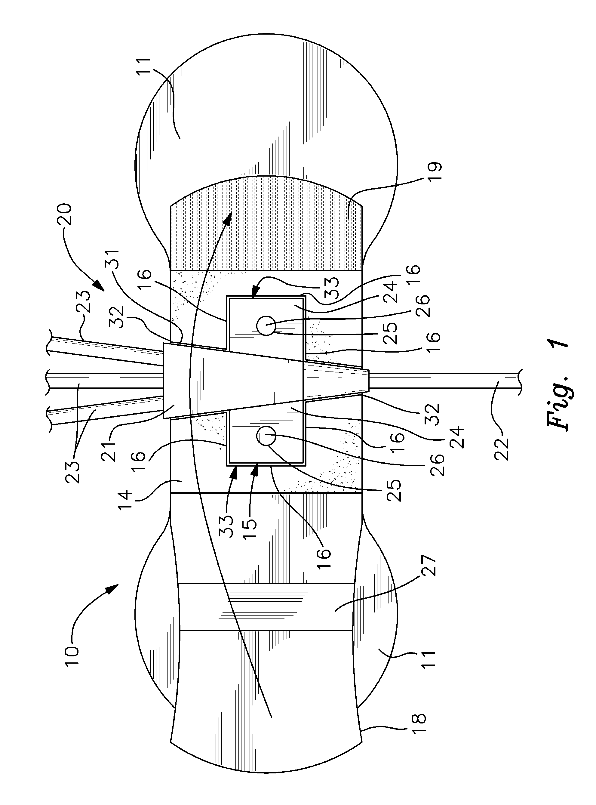 Catheter anchor