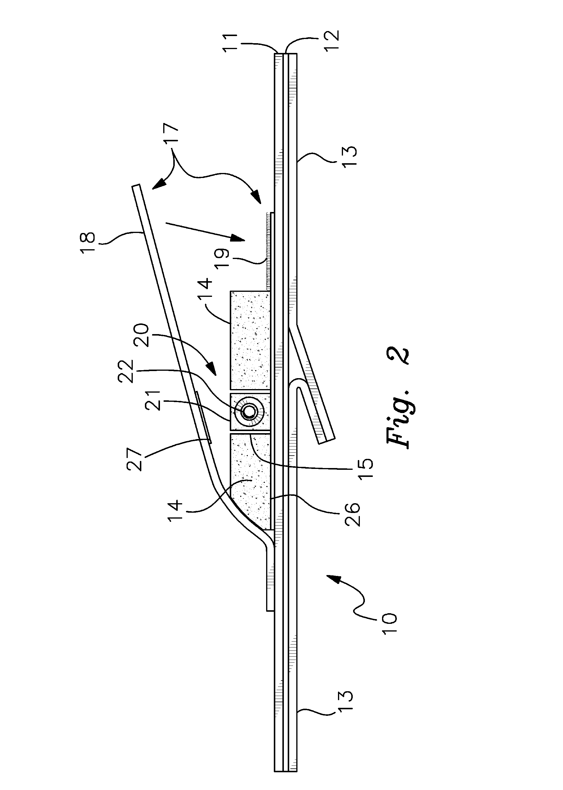 Catheter anchor