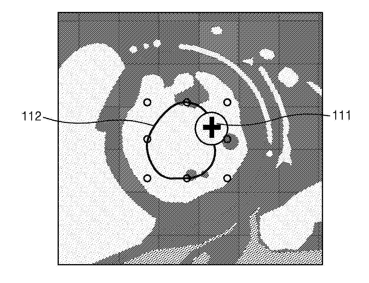 Medical image processing apparatus and medical image processing method