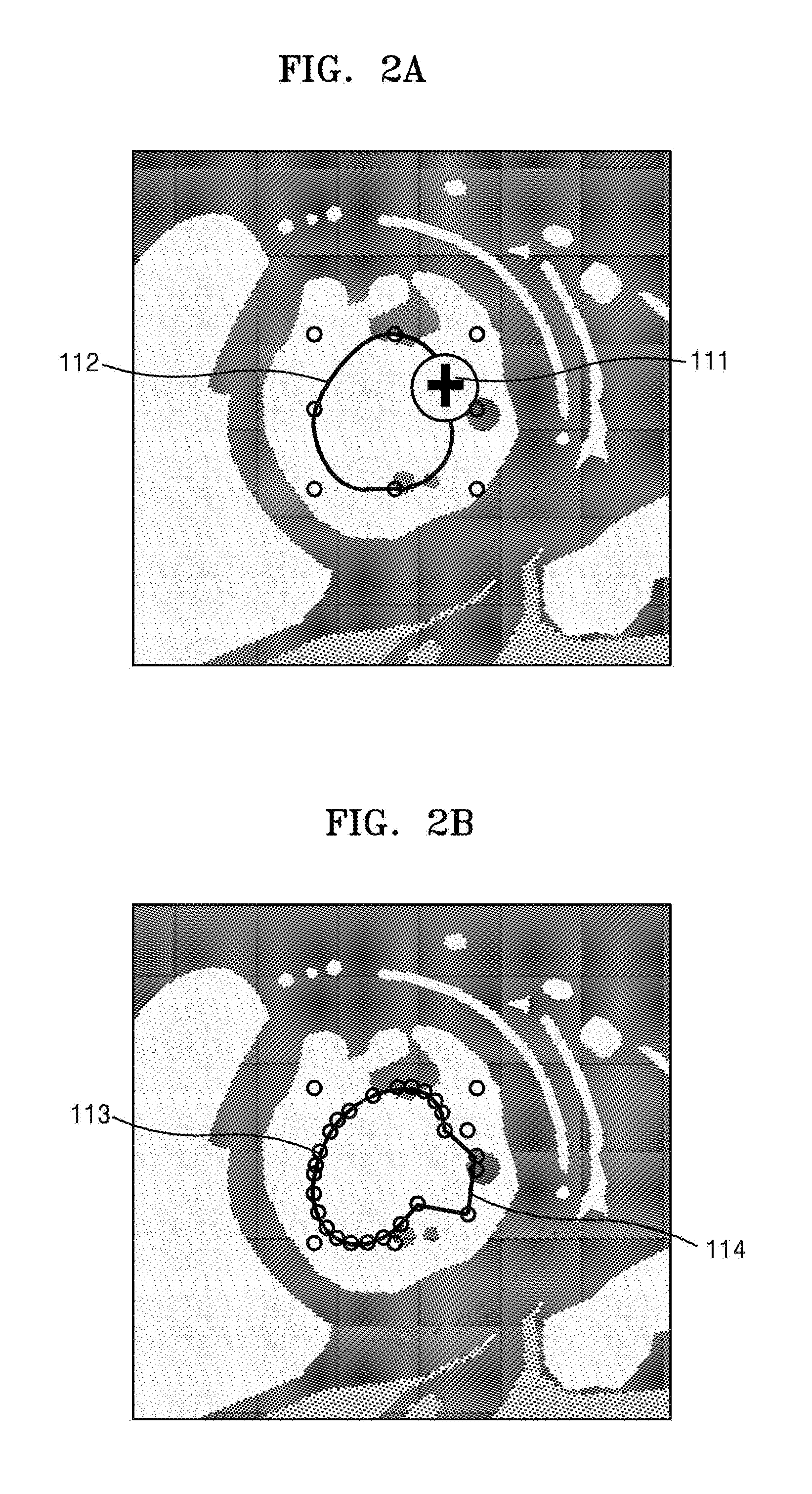 Medical image processing apparatus and medical image processing method