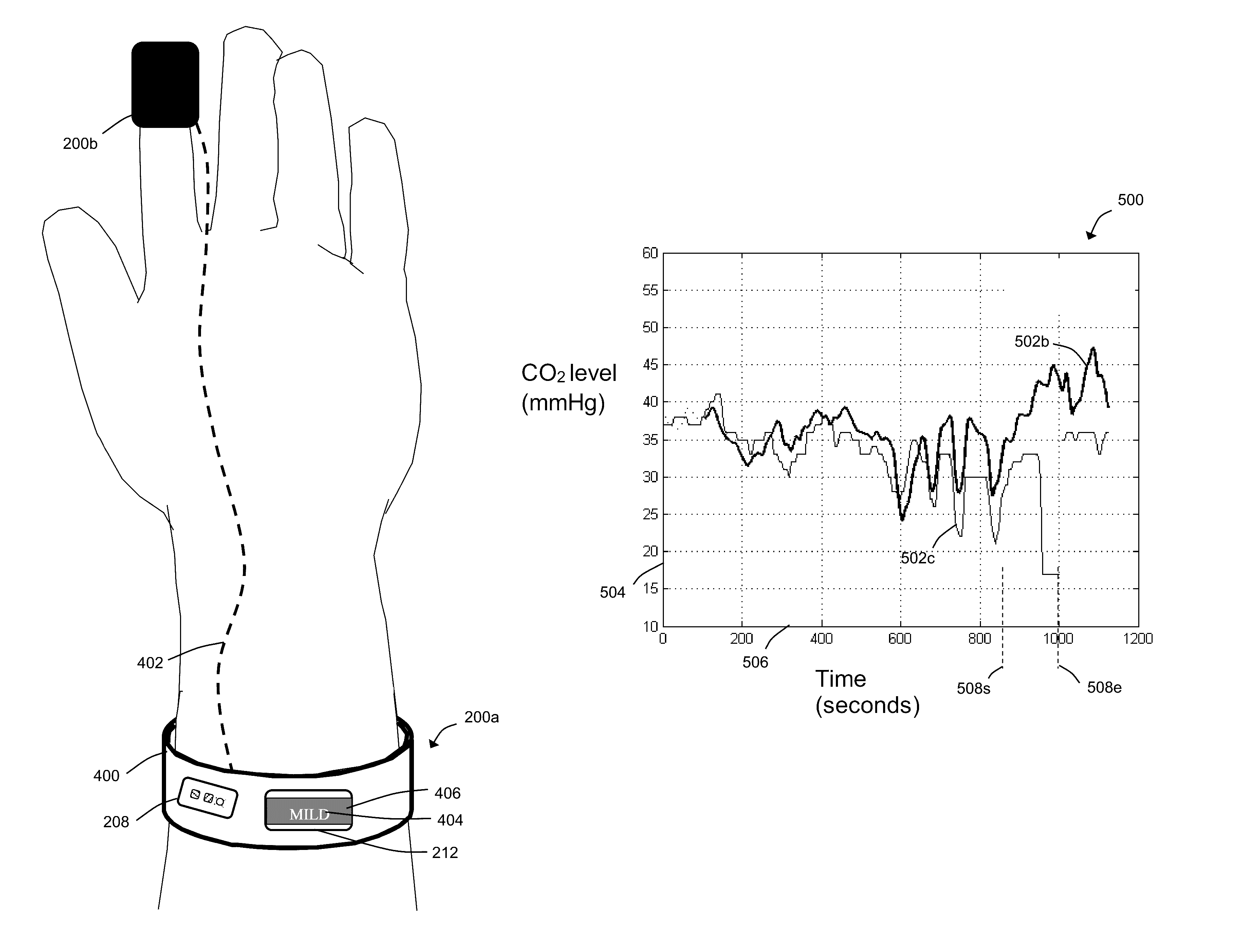 Hemodynamics-based monitoring and evaluation of a respiratory condition