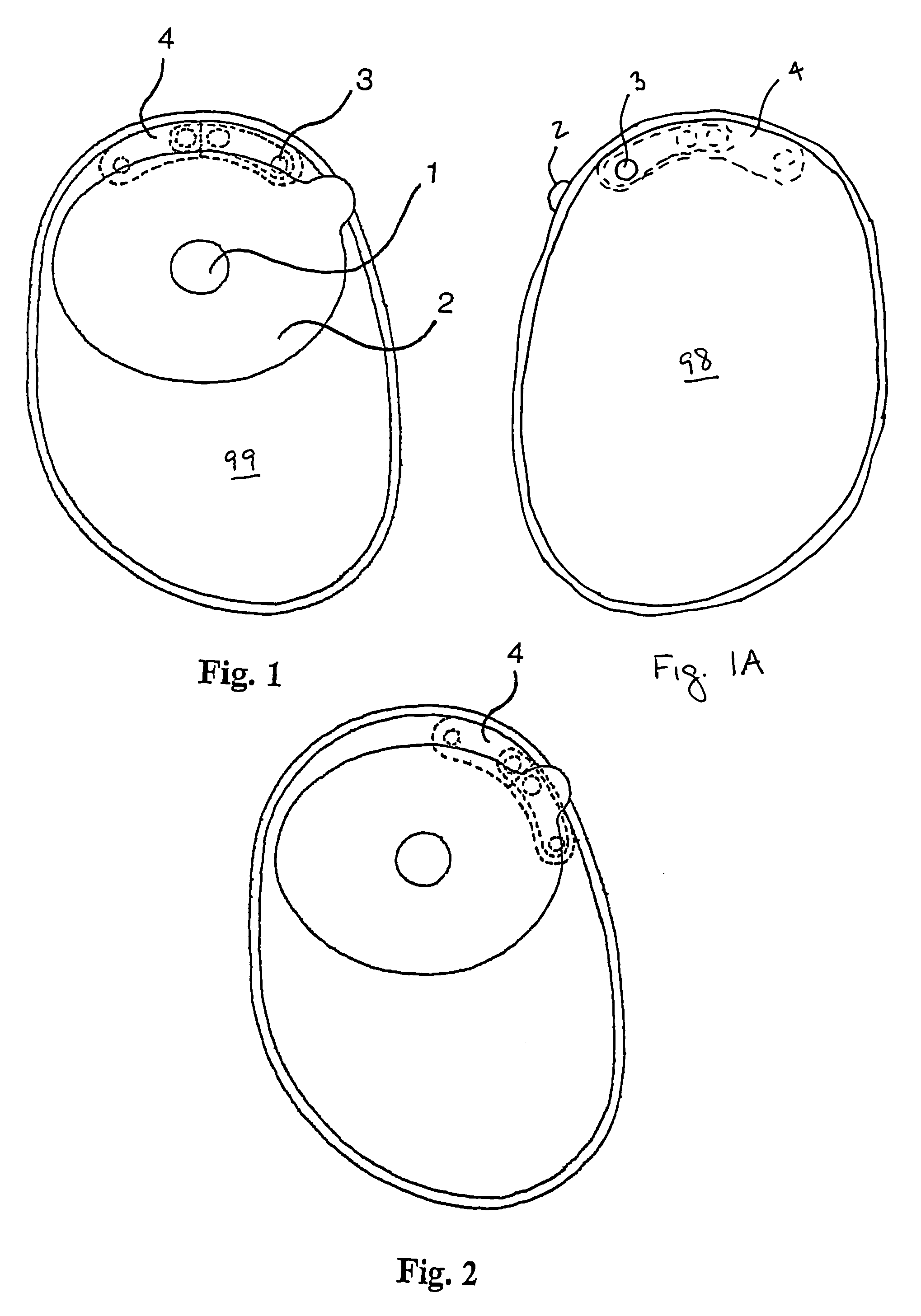 Ostomy appliance with multiple openings for preventing filter input blockage