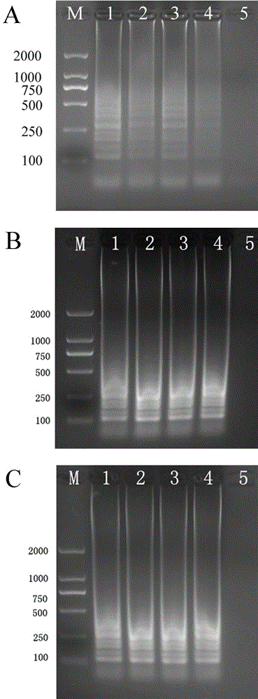 Loop-mediated isothermal amplification primer set for identifying three kinds of pratylenchus pratensis on sugarcane and kit comprising loop-mediated isothermal amplification primer set