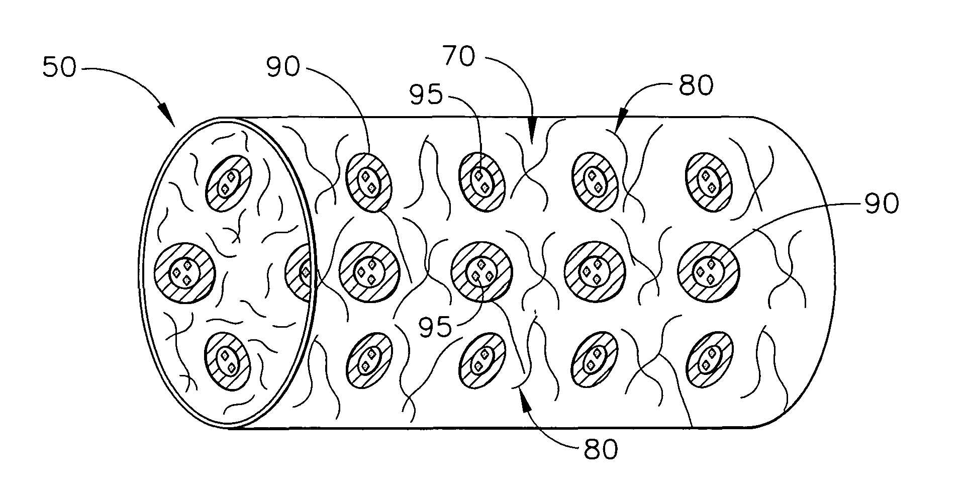 Biodegradable medical implant with encapsulated buffering agent