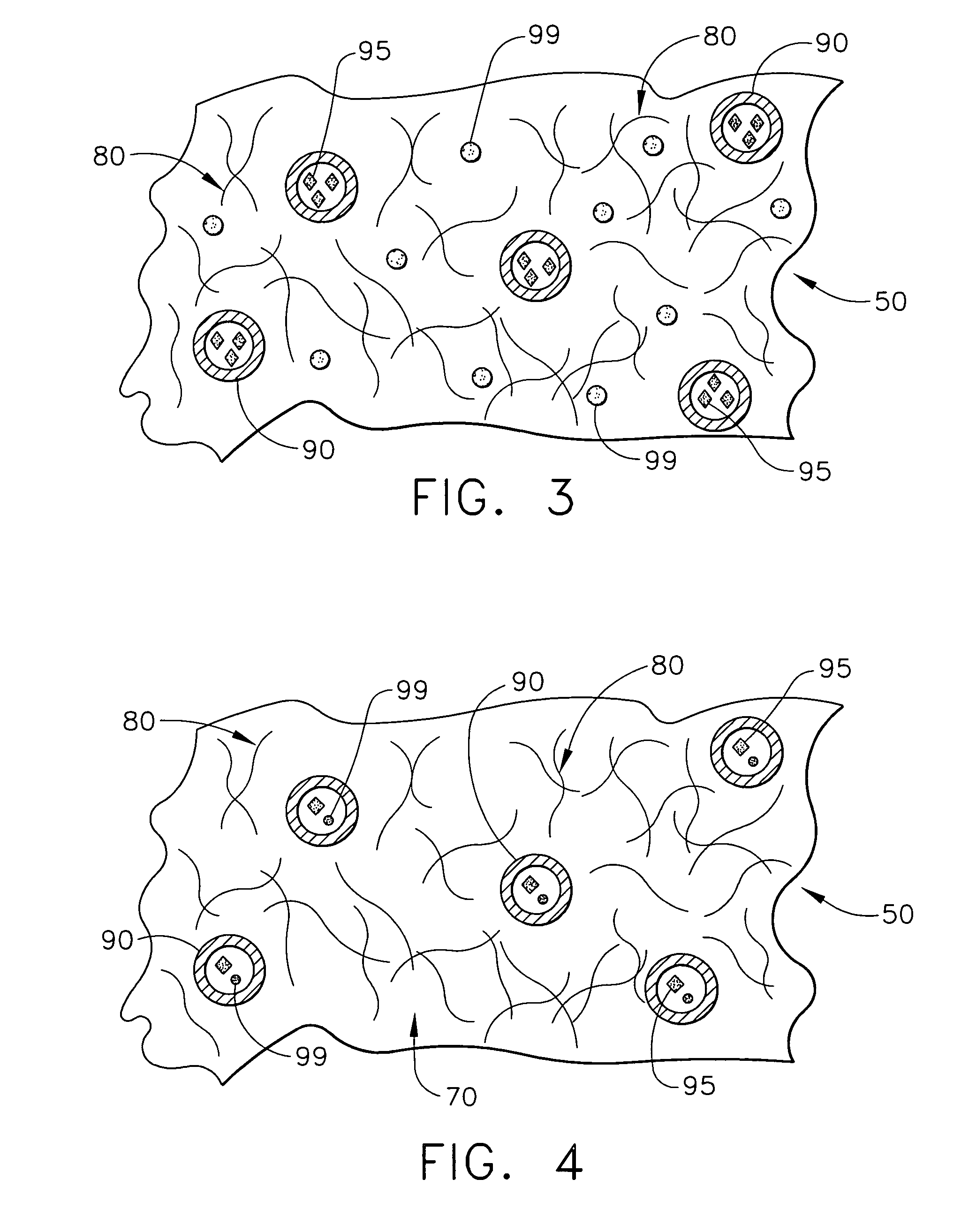 Biodegradable medical implant with encapsulated buffering agent