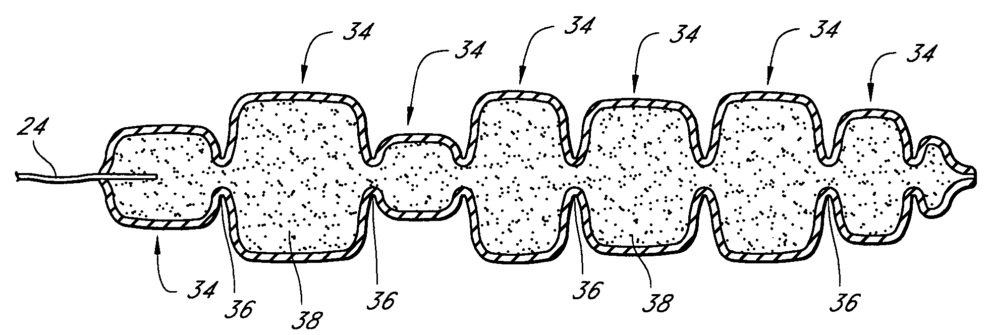 Systems and devices for soft tissue augmentation