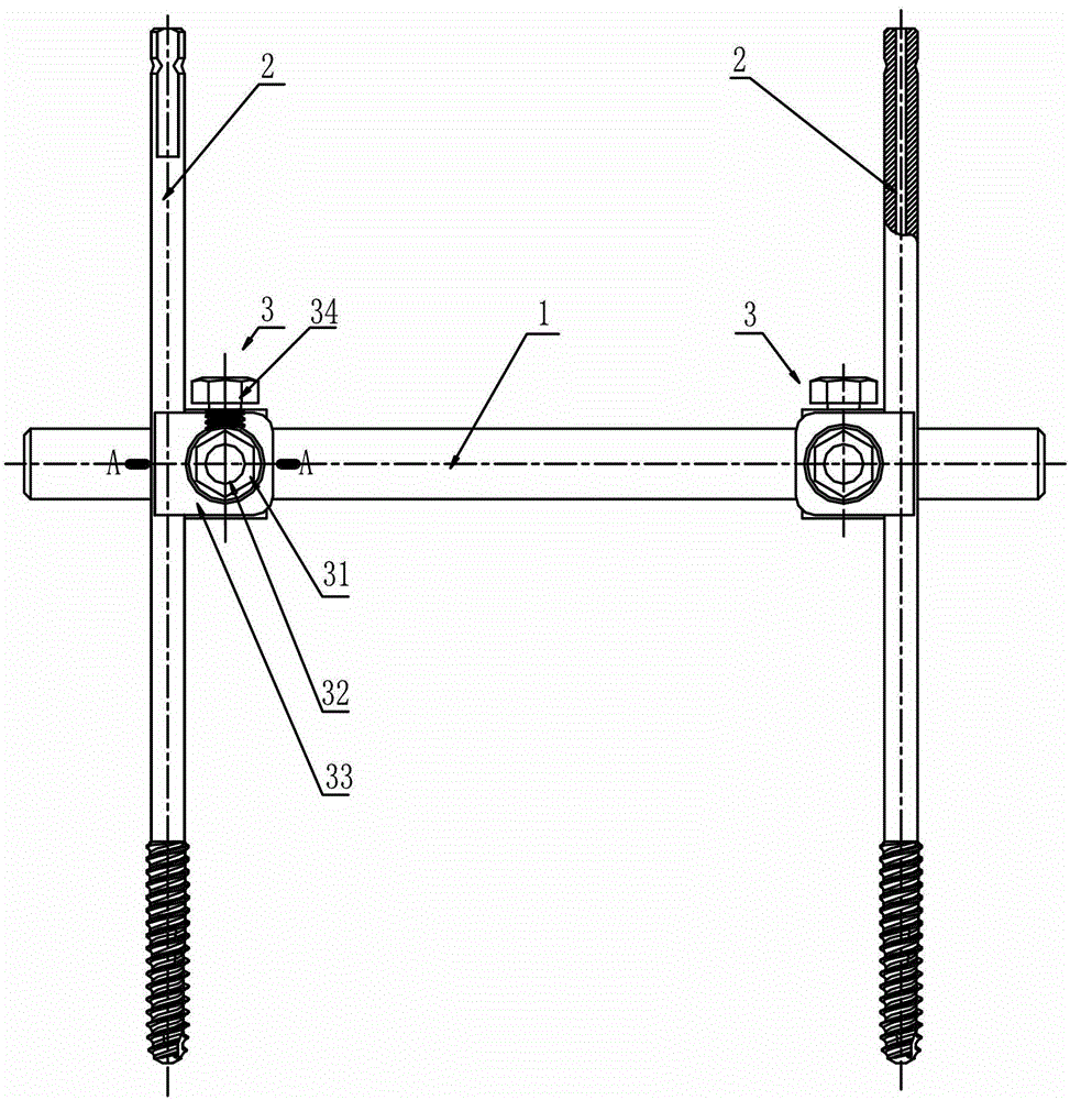 External thoracolumbar vertebra distraction repositor