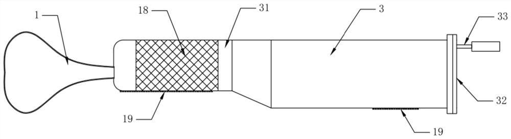 Self-release balloon dilatation uterus stent capable of automatically controlling pressure