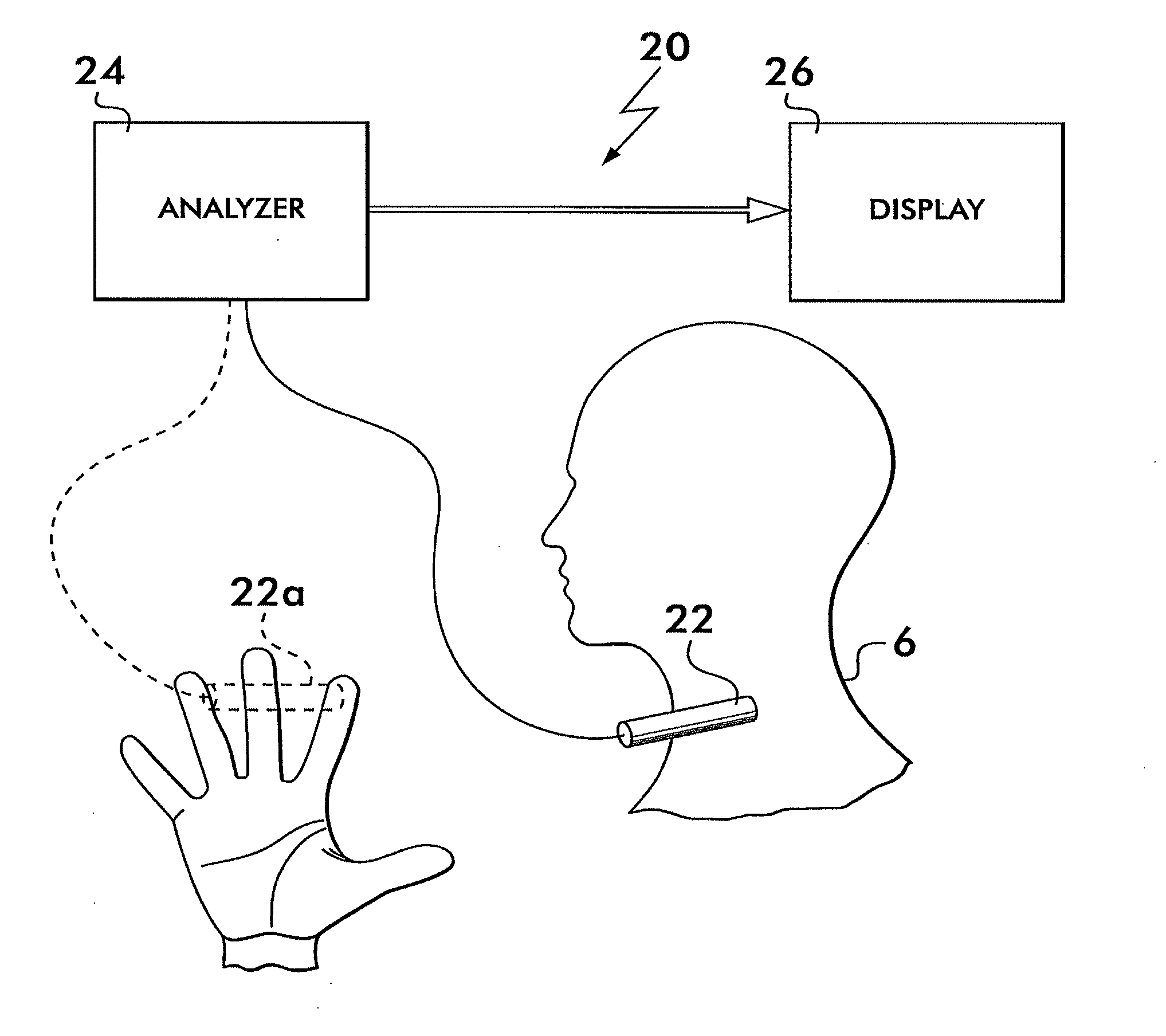 Non-invasive intracranial pressure sensor