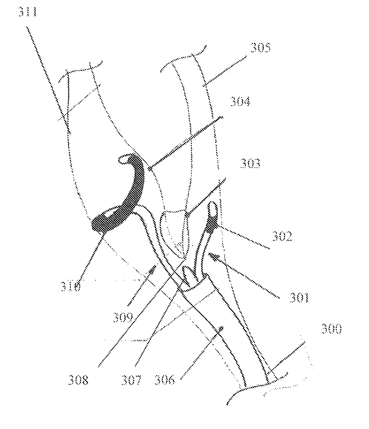 Electrostimulation in treating cerebrovascular conditions