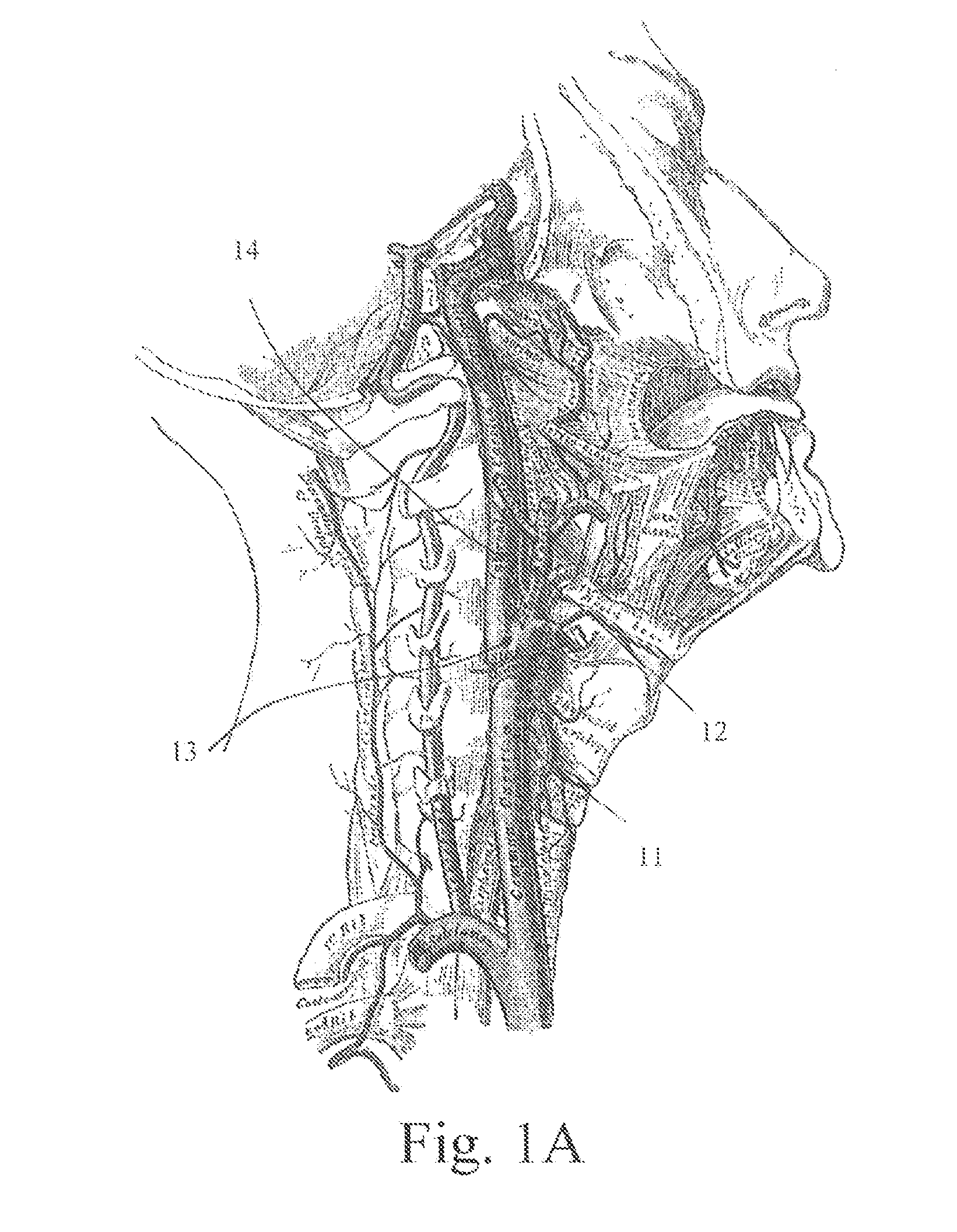 Electrostimulation in treating cerebrovascular conditions