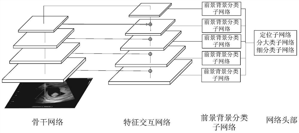 Ultrasonic section identification method and system, computer equipment and storage medium