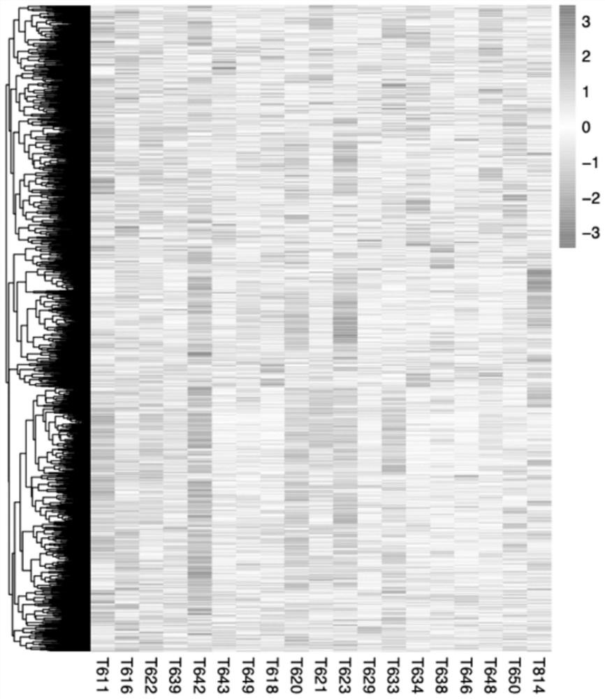 Application of VAV2 in prediction of radiotherapy sensitivity and prognosis of patient