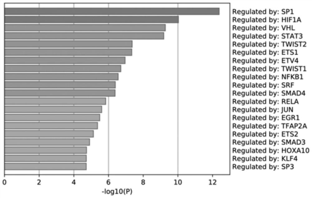 Application of VAV2 in prediction of radiotherapy sensitivity and prognosis of patient