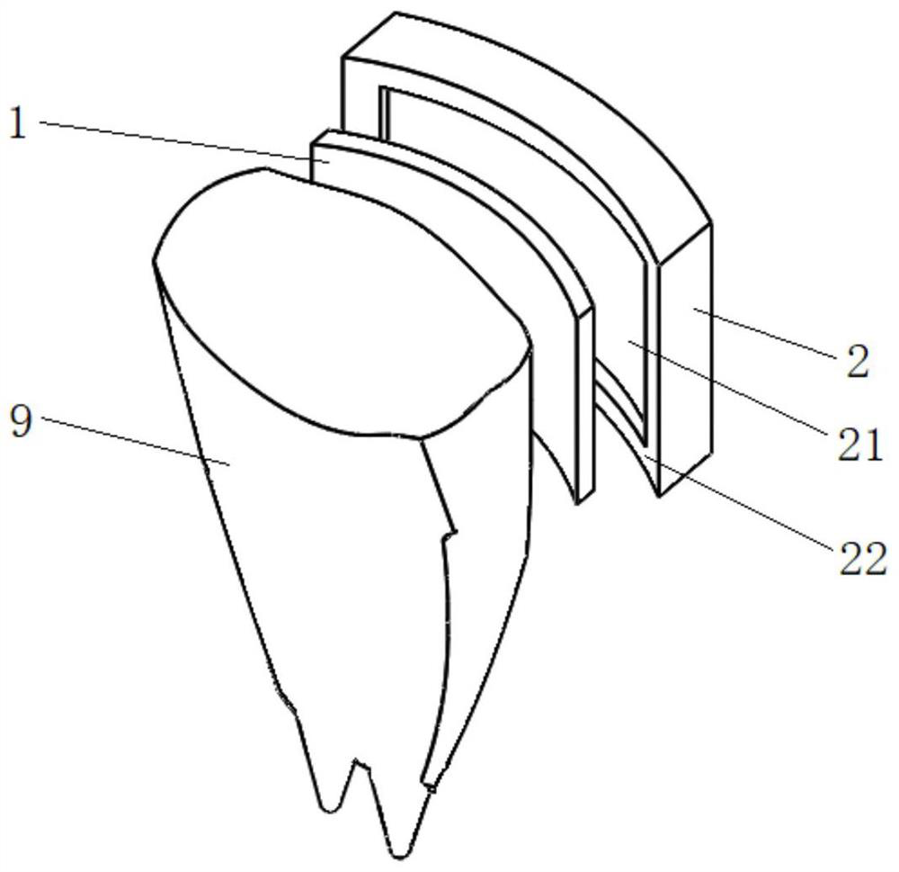 Preparation method of tooth whitening elastic veneering bridge and product thereof