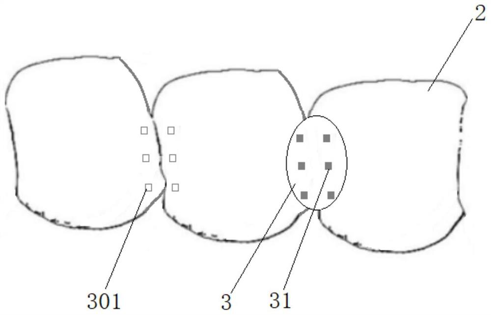 Preparation method of tooth whitening elastic veneering bridge and product thereof