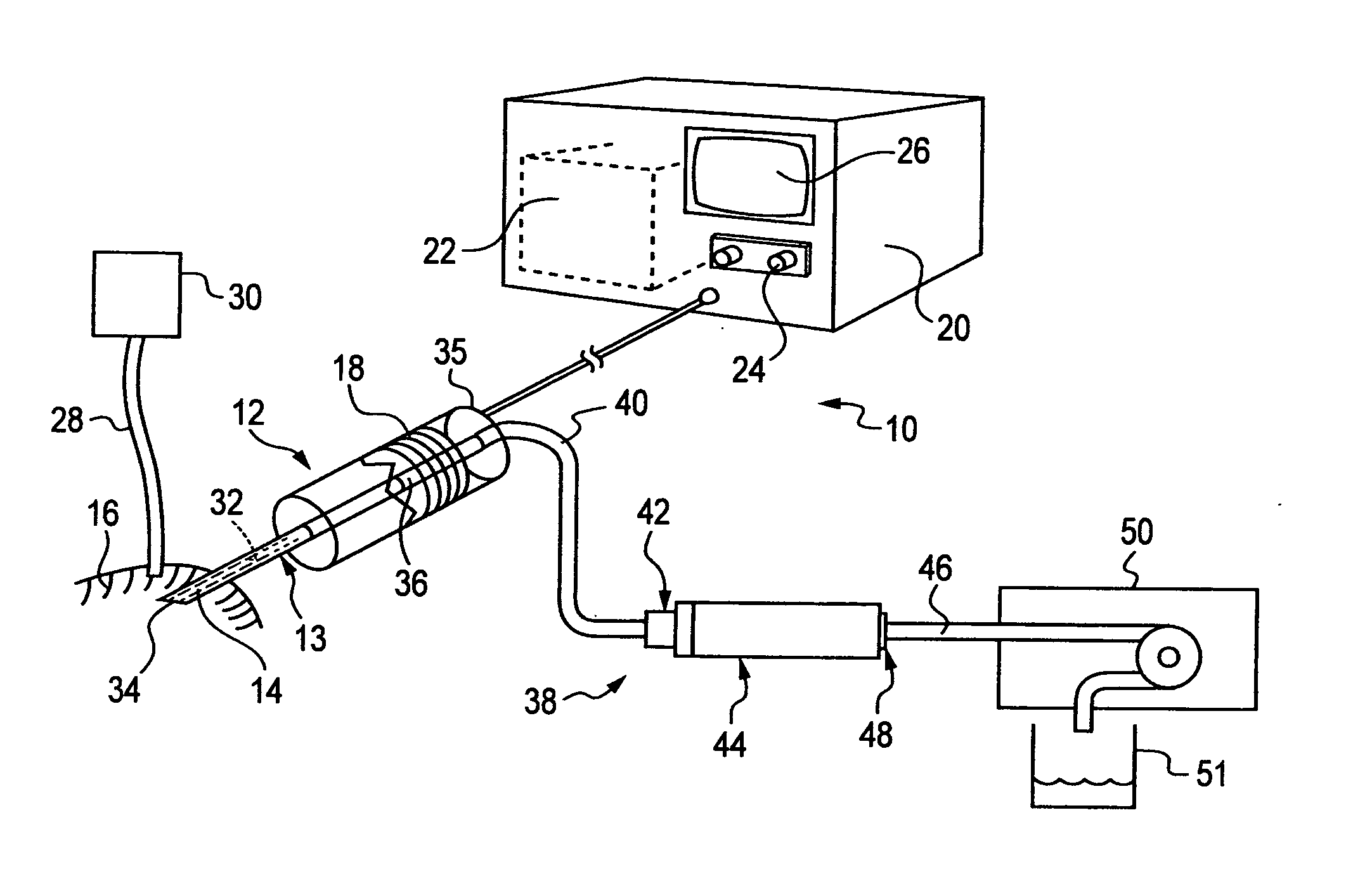 Surgical apparatus and methods asociated therewith