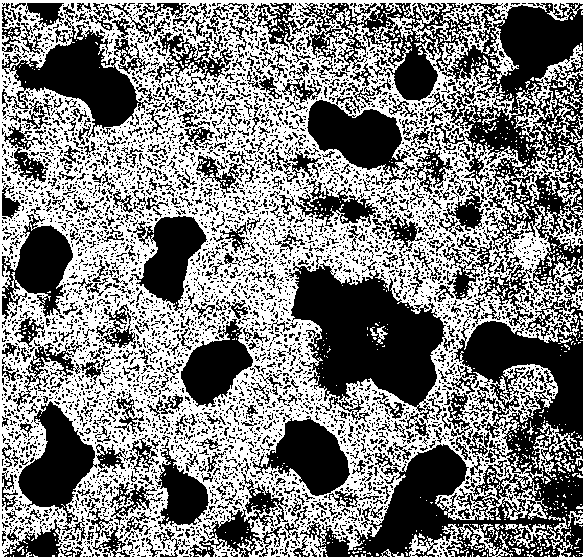 Tumor cell nanogold vesicle and preparation method and application thereof, and tumor cell immune nanogold vesicle and preparation method and application thereof