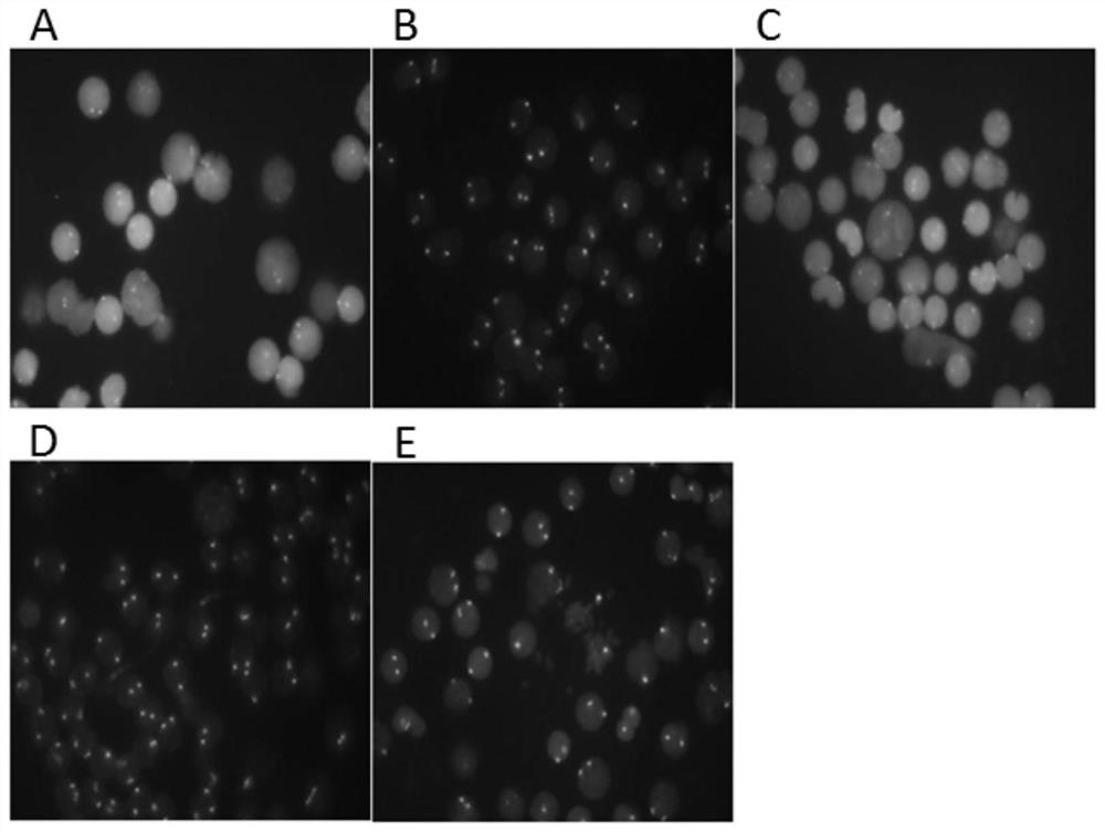 DAPI redyeing solution and preparation method and application thereof