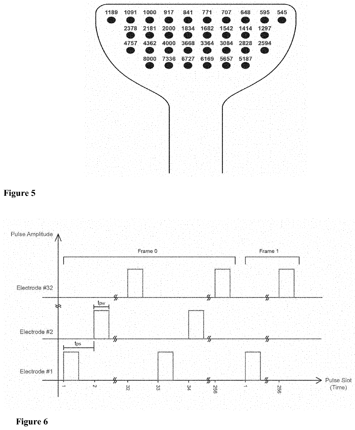 An apparatus and method for treating a neurological disorder of the auditory system