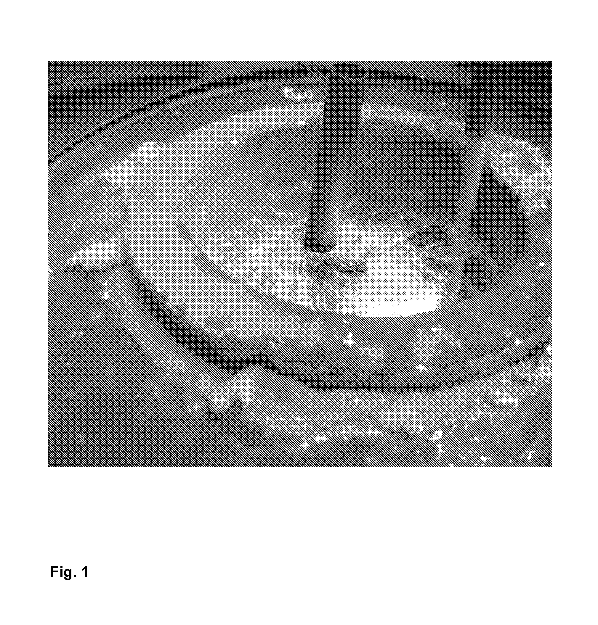 Flux and fluxing bath for hot dip galvanization, process for the hot dip galvanization of an iron or steel article