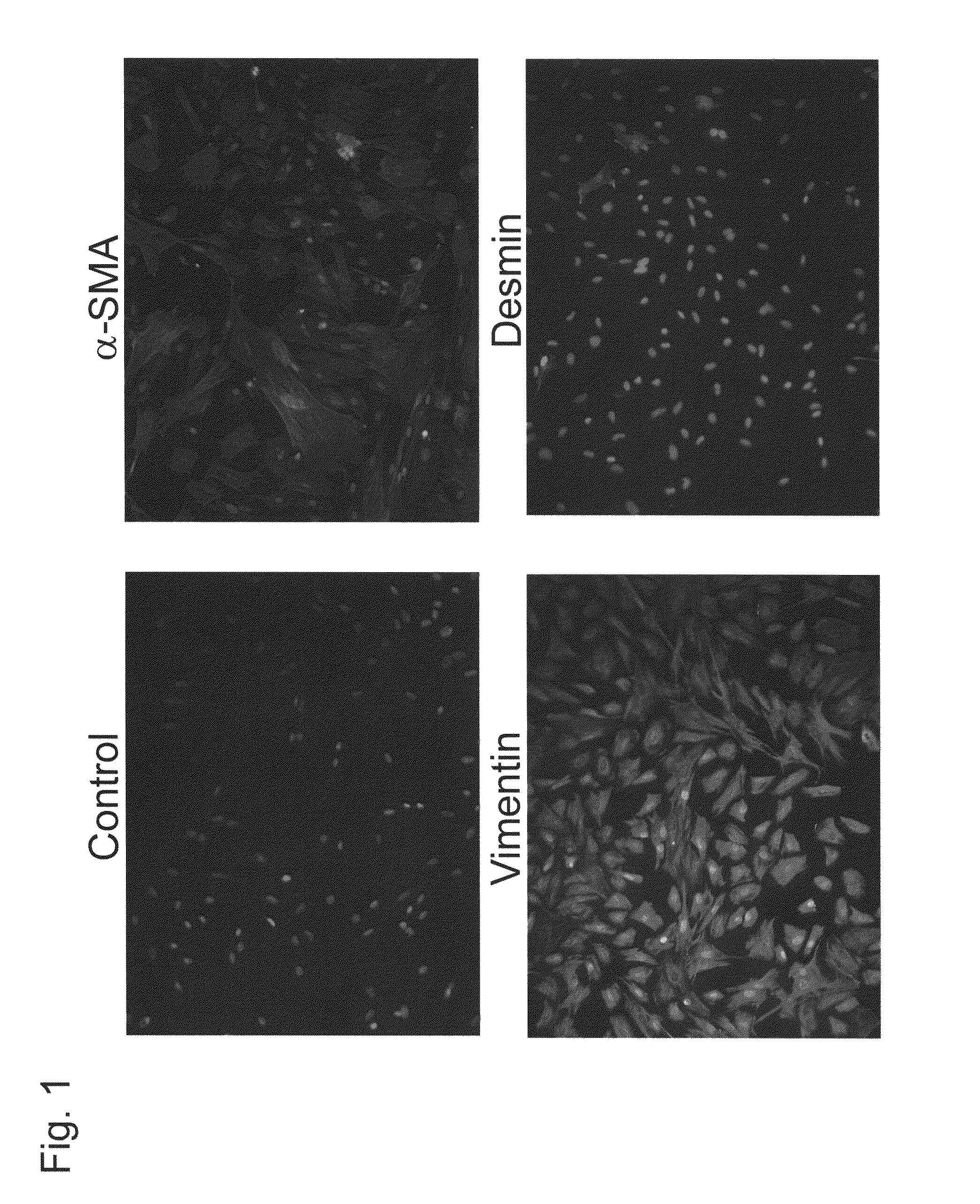 Targeting agent for cancer cell or cancer-associated fibroblast