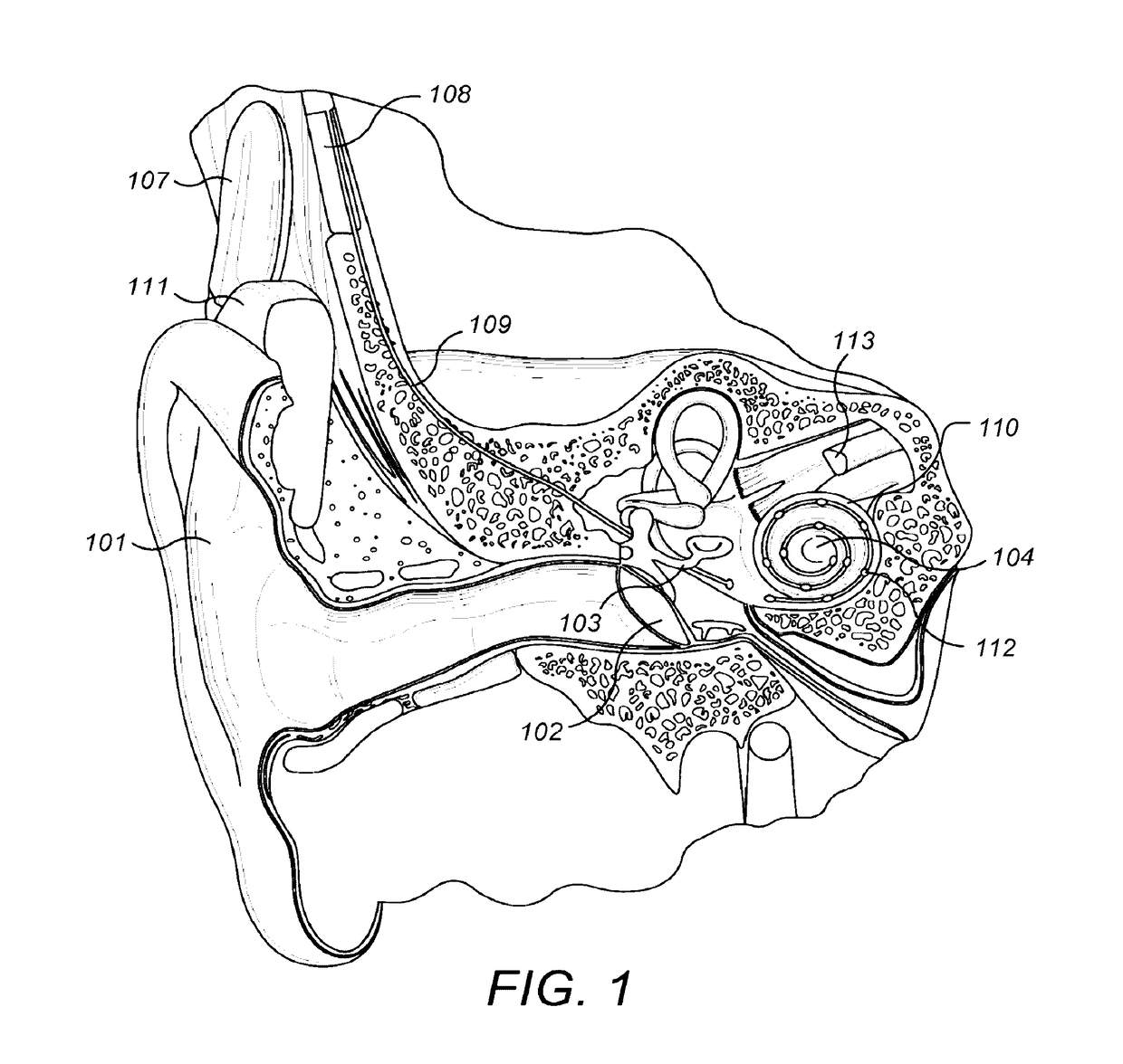 Interaural Coherence Based Cochlear Stimulation Using Adapted Fine Structure Processing