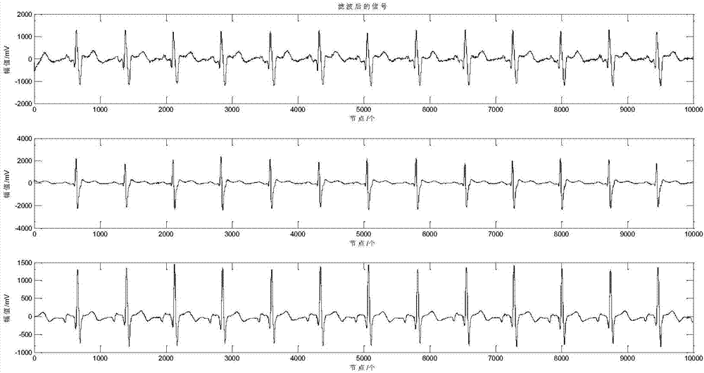 P-wave extracting method based on orthogonal projection and independent component analysis