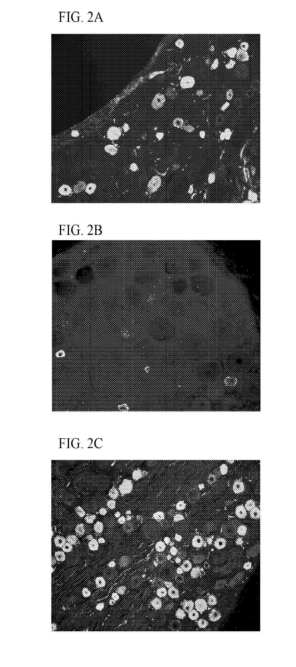 Materials and methods for treating regional pain