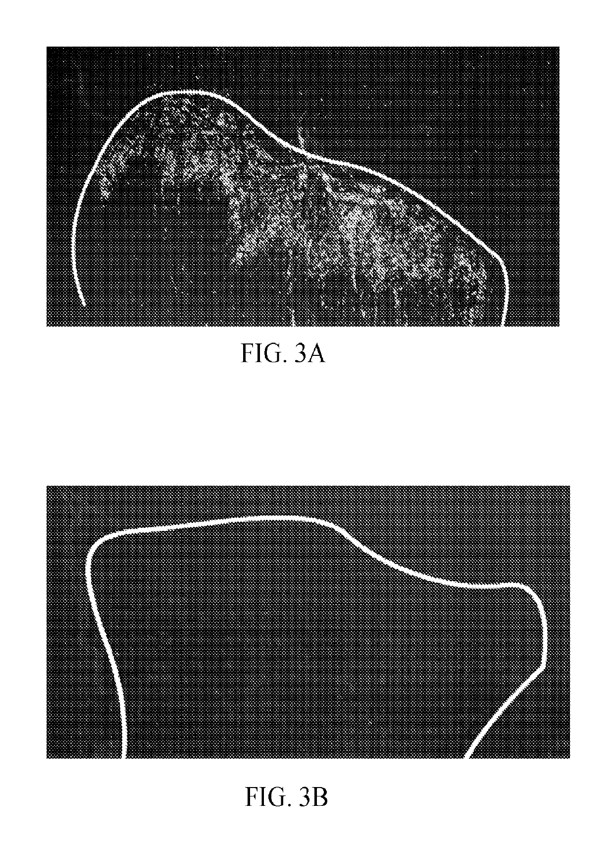 Materials and methods for treating regional pain