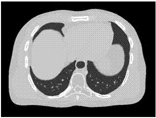 Augmented lagrangian iterative reconstruction method of X-ray image and CI image